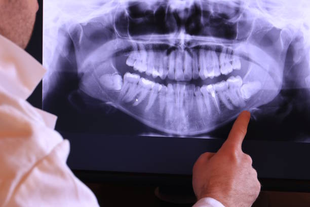 Best Chipped Tooth Repair Near Me  in Tioga Terrace, NY